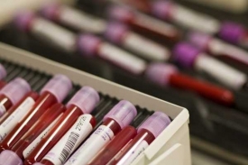 Vzorky krve v jedné švýcarské laboratoři nedaleko Lausanne.