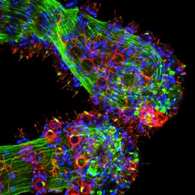 Pohled do nezmařích útrob: bílkovina reagující na světlo modře, žahavé buňky a nervová spojení červeně.