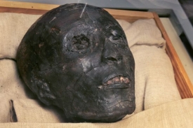Tutanchamon trpěl řadou zdravotních problémů a zemřel velmi mladý.