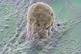 V USA se po osmi letech uvolní pravidla pro výzkum kmenových buněk.